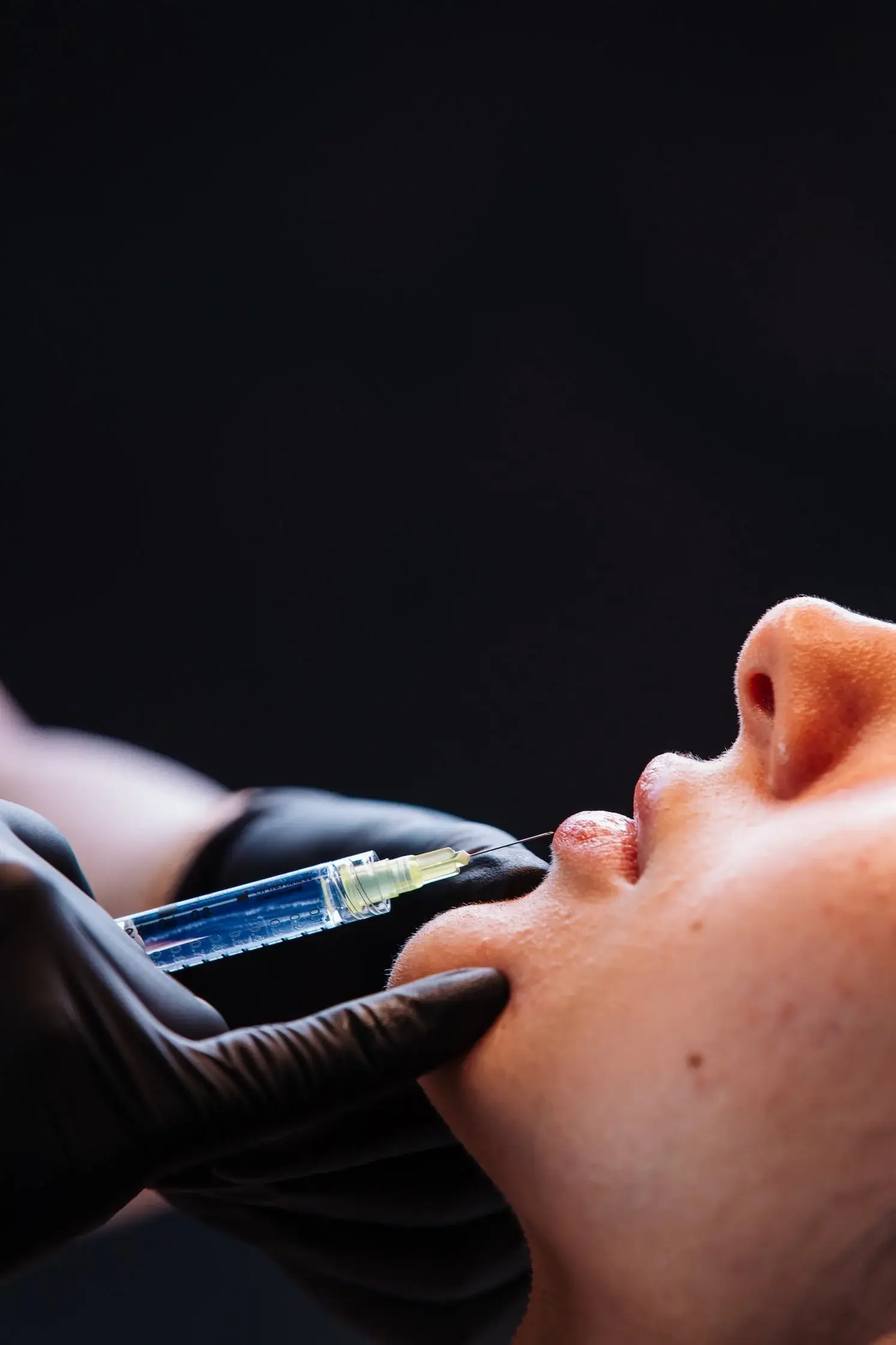 Close view of a lip filler injection at Katherine O Aesthetics