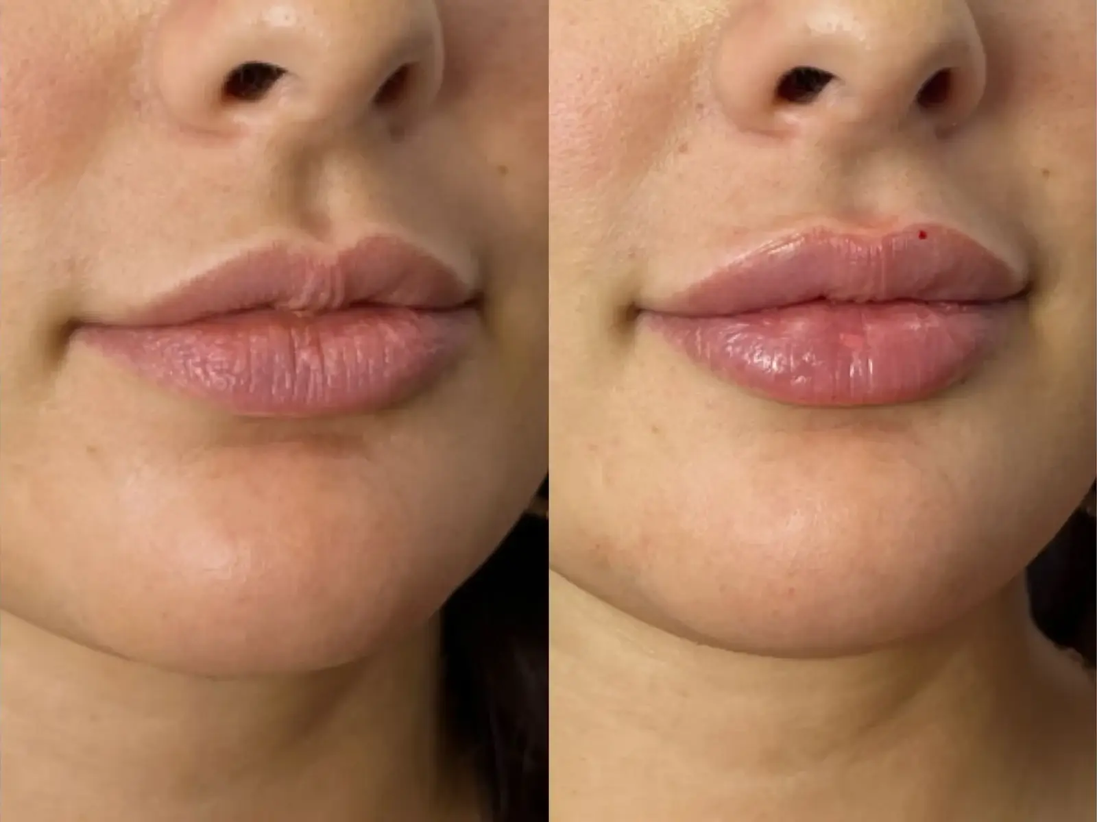 Two close views of the mouth, taken straight on