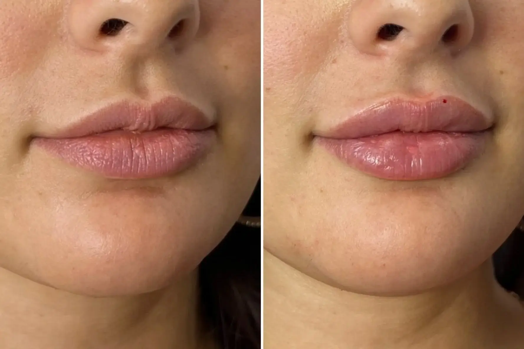 Original side-by-side, lip enhancement