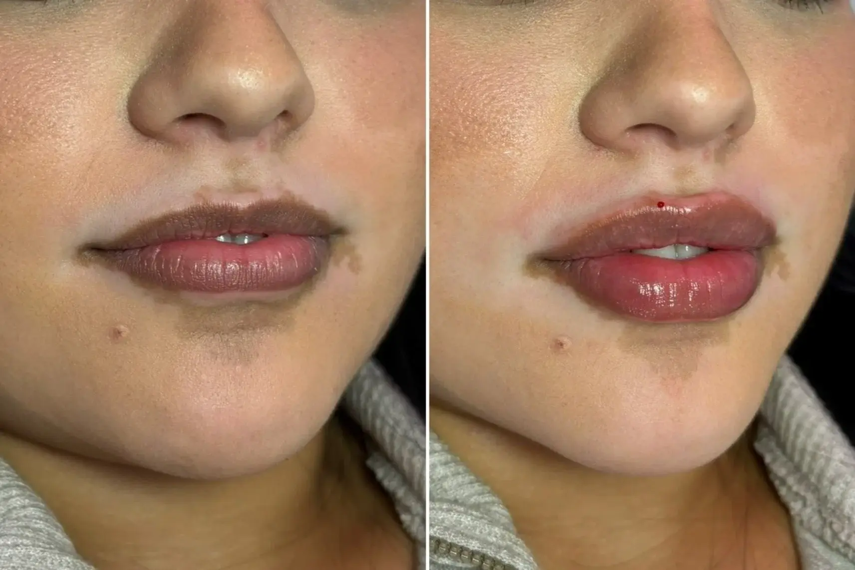 Original side-by-side, lip enhancement